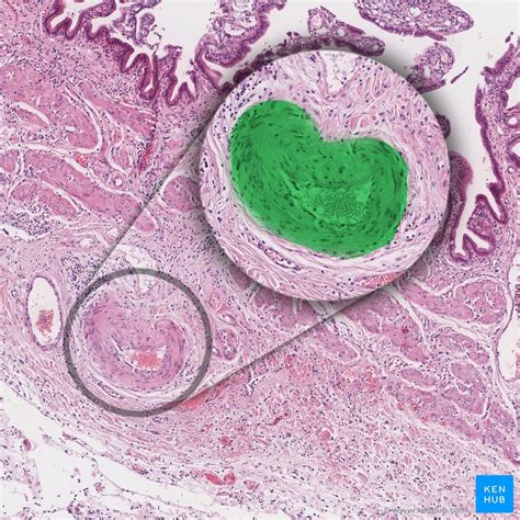 The renal vein leaves the kidneys and carries the blood back to the heart. Blood vessels: Histology and clinical aspects | Kenhub