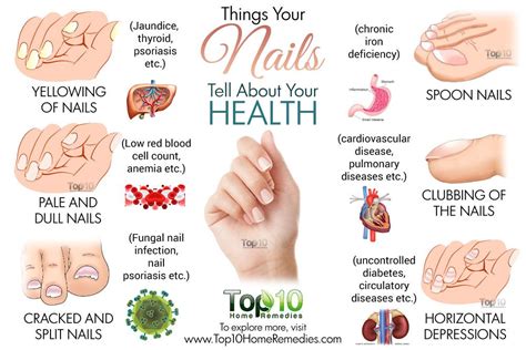 What Your Nails Reveal About Your Health Nail Health Signs White Spots