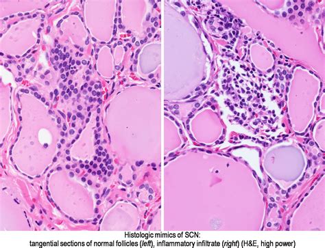 Pathology Outlines Histology