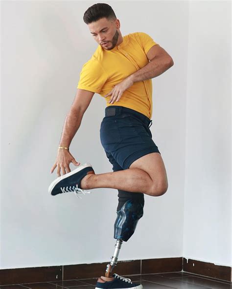 Amputee Legs Stumps And Prostheses