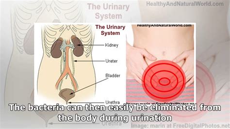 How To Treat Urinary Tract Infection UTI Naturally YouTube
