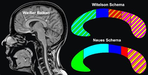 Nervenverbindungen Im Menschlichen Gehirn Neu Bestimmt Max Planck
