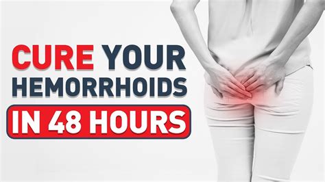Treatments For Hemorrhoids How To Shrink Hemorrhoids Fast And Naturally