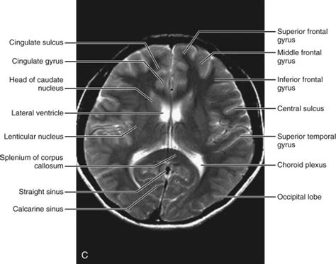 Normal Anatomy Radiology Key