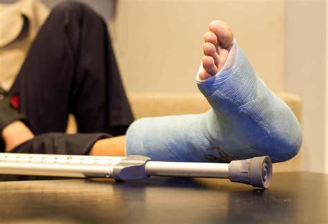 Foot Fractures Ankle Andfoot Clinic Of Everett