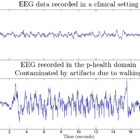 2 Contaminating Effect Of Artifacts On Recorded Eeg Signals In The Download Scientific