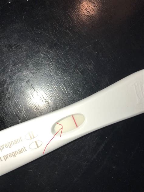 Ttc After A Miscarriage And A Ectopic Pregnancy Glow Community
