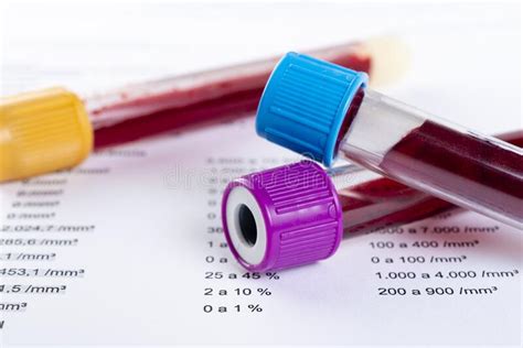 Blood Test Tube With Full Blood Count In The Background Stock Image