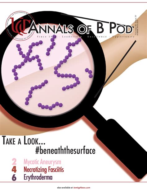 June Issue Annals Of B Pod — Taming The Sru