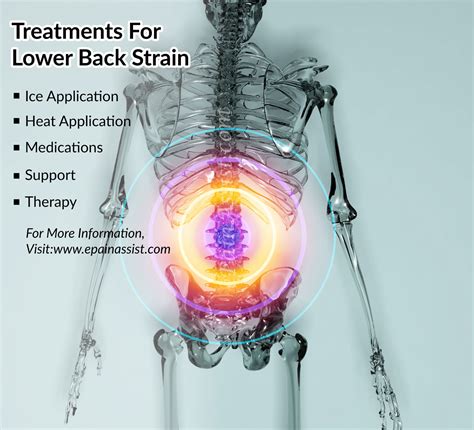 Lower Back Strain Treatment Prevention Symptoms Causes