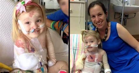 3 Yr Old Loses Arm After Horrible Infection Then Asks Mom 1 Question