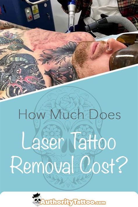 Everything You Need To Know About Laser Tattoo Removal Prices And How Much The Whole Process