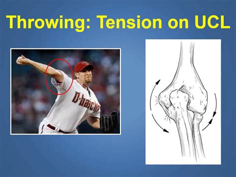 Valgus stress test of the knee⎟medial collateral ligament. Ulnar Collateral Ligament Injuries & Treatment Explained ...