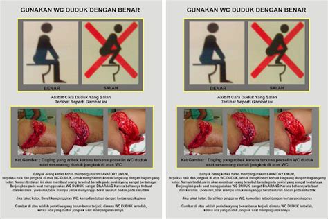 Akibat Fatal Apabila WC Duduk Dipakai Untuk Jongkok Foto Eksklusif