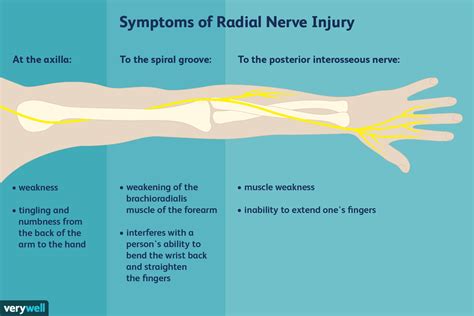 The Radial Nerve And Its Branches Radial Nerve Nerve