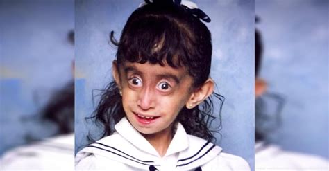 bullies called her “world s ugliest woman” after years of hiding she finally does this