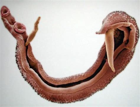 Schistosomatoza Bilharcjoza Objawy I Leczenie Choroby Dicas Para The