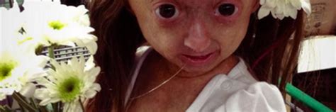 Adalia Rose DicasAdalia Twitter