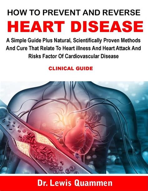 How To Prevent And Reverse Heart Disease Ebook Dr Lewis Quammen