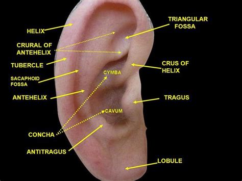 Auricular hematoma - WikEM