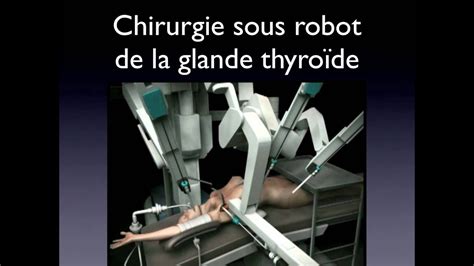 Thyroidectomie Robot Trans Axillary Robotic Thyroidectomy YouTube