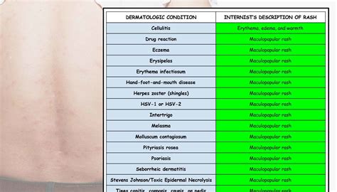 An Internists Guide To The Description Of Rashes Gomerblog