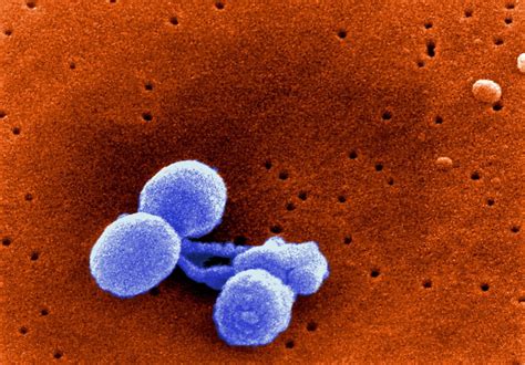 Free Picture Gram Positive Streptococcus Pneumoniae Bacteria