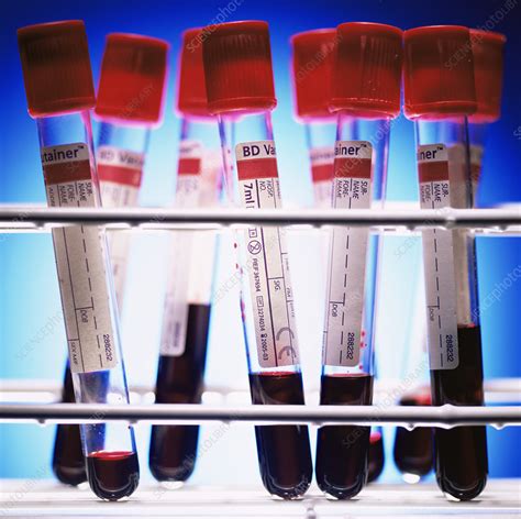 Blood Samples Stock Image M5300636 Science Photo Library