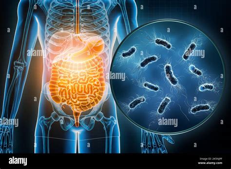 Bacterial Infection Of The Gastrointestinal Tract 3d Rendering