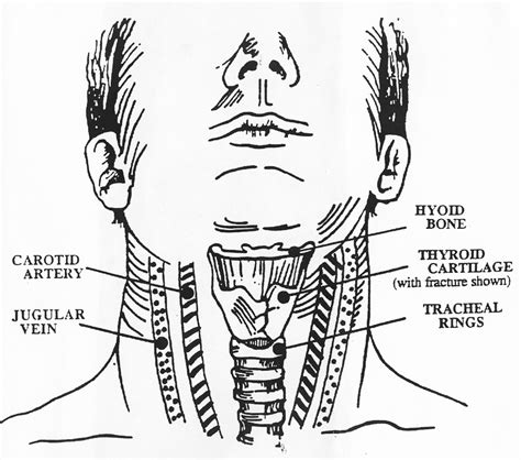 Neck, in land vertebrates, the portion of the body joining the head to the shoulders and chest. Neck Diagrams to Print