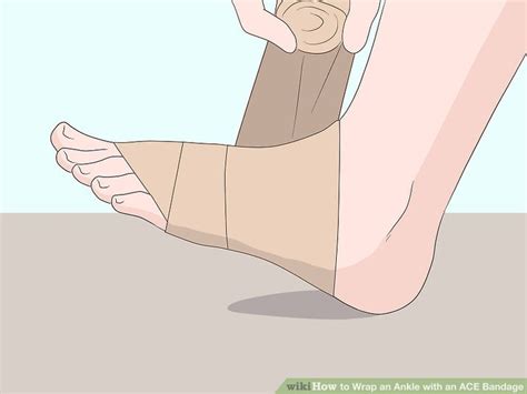 3 Easy Ways To Wrap An Ankle With An Ace Bandage Wikihow