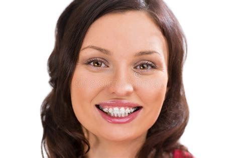 Closeup Portrait Of Charming Woman Wearing Orthodontic Ceramic Brackets Stock Photo Image Of