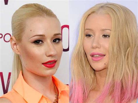 Iggy Azalea Is Plastic Fantastic At Billboards—shows Off New Nose And