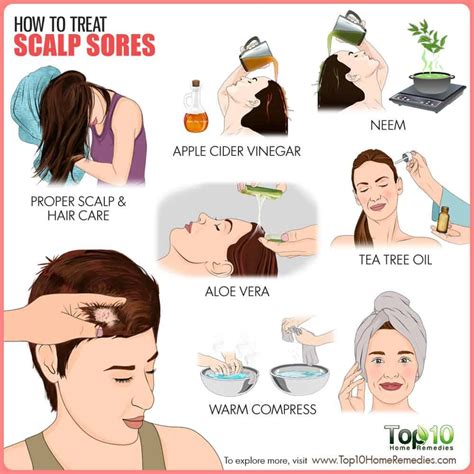 How To Treat Extra Dry Scalp Heal Info