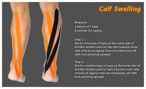 Injury To The Calf Muscle Caused By Strain Leads To Swelling Bruising