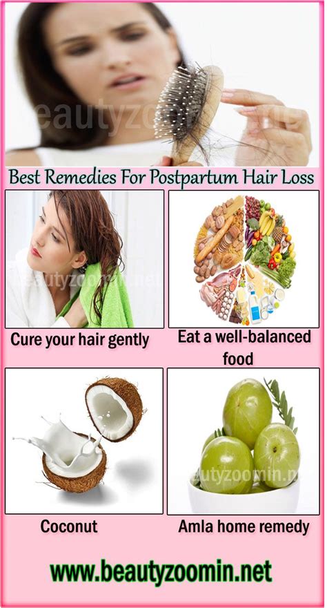 Treating Postpartum Hair Loss Rijal S Blog
