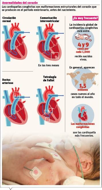 Las Cardiopatías Congénitas En La Edad Pediátrica