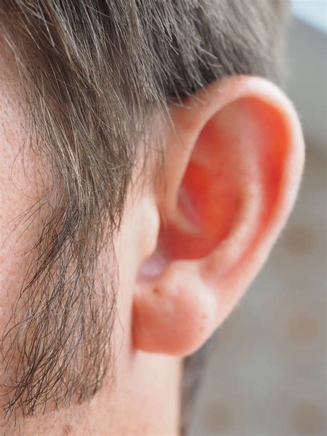 Continued Ear Wax Services Crucial Say Researchers