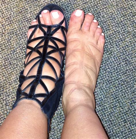 Effiong Eton Kim Kardashian Post Pic Of Her Swollen Feet
