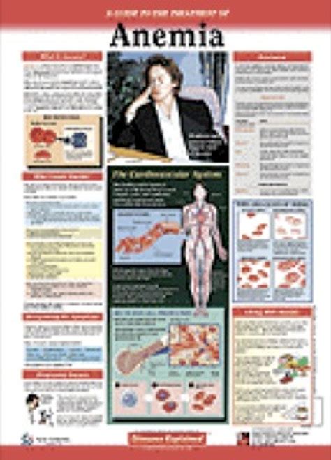 Osteoporosis Patient Anatomical Chart Clinical Charts And Supplies