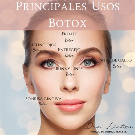 Qué es y cómo funciona el Botox Dra Lietza Salud y Belleza