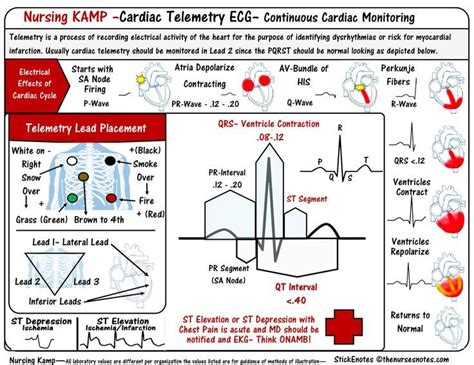 Cardiac Ecg Ekg Electrocardiogram Telemetry Overview Of