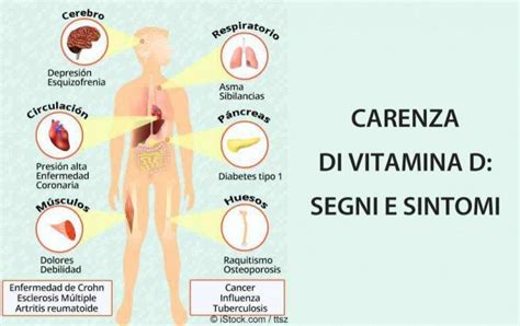 Vitamina D Segni E Sintomi Di Carenza Sanieattivi It Vitamina D