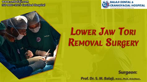 Jaw Tori Removal Surgery Jaw Surgery In Chennai India Cosmetic