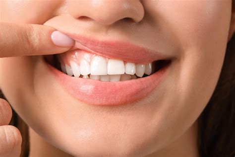 The Importance Of Keeping Your Gums Healthy