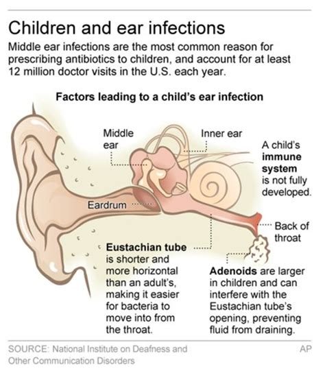 Antibiotic Gel Might Be Better Option For Ear Infections Nbc News