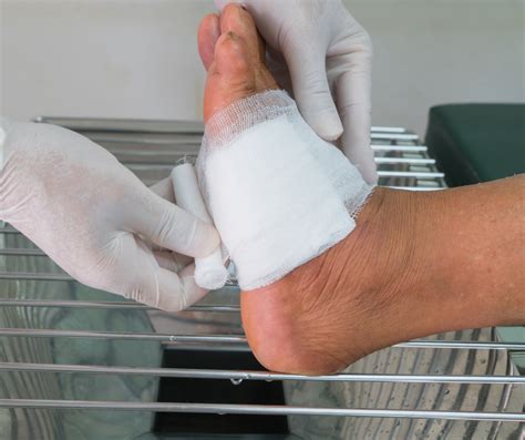 What To Know About Wound Care