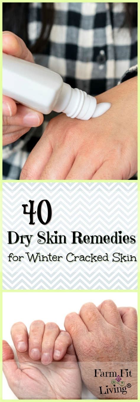 40 Dry Skin Remedies For Winter Cracked Skin Skin Remedies Dry Skin