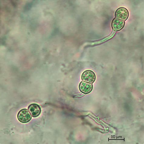 Fusarium Falciforme A Pathogen Causing Wilt Disease Of Chrysanthemum