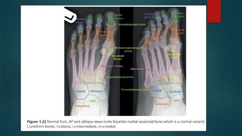 Msk X Ray Normal Anatomy